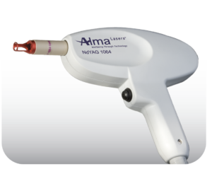 ND:YAG LASER